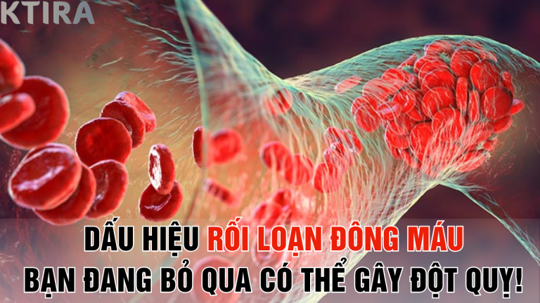 Mệt Mỏi, Tê Bì? 5 Dấu Hiệu Rối Loạn Đông Máu Bạn Đang Bỏ Qua Có Thể Gây Đột Quỵ!