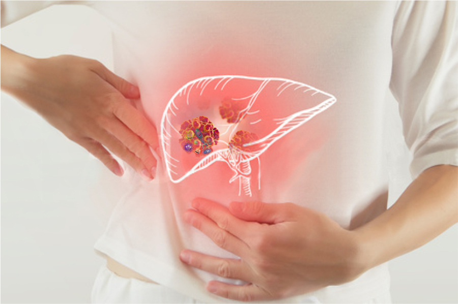 Phần 3: Dấu Hiệu Cảnh Báo Xơ Gan