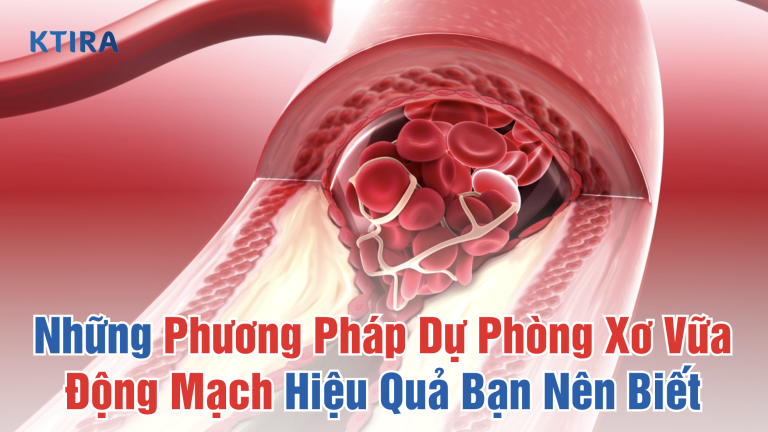 Những Phương Pháp Dự Phòng Xơ Vữa Động Mạch Hiệu Quả Bạn Nên Biết