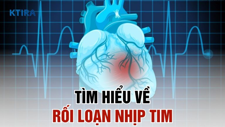 Tìm Hiểu Về Rối Loạn Nhịp Tim: 4 Dấu Hiệu, Nguyên Nhân và Cách Xử Lý