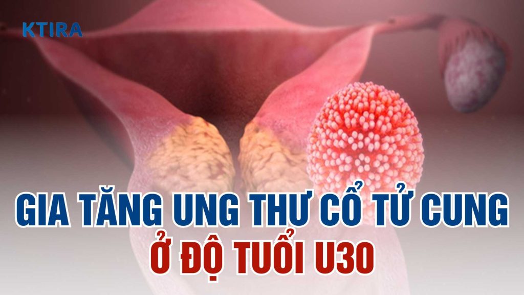 Gia tăng ung thư cổ tử cung