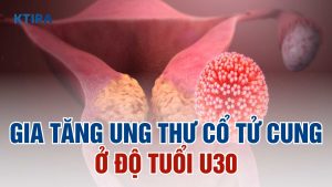 Gia tăng ung thư cổ tử cung
