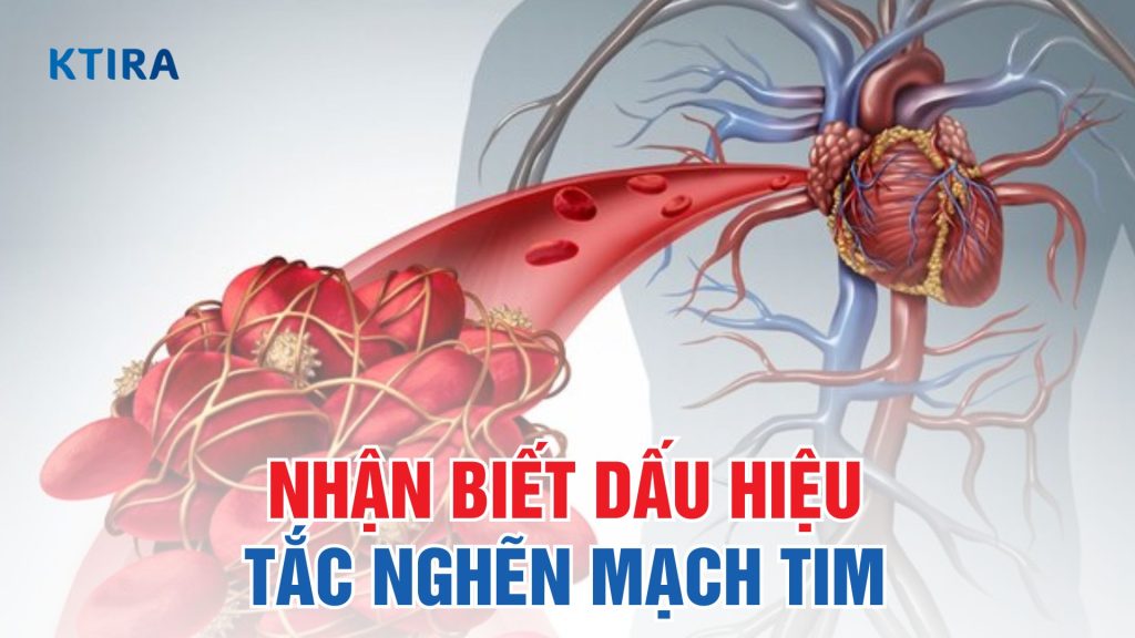 Dấu hiệu tắc nghẽn mạch tim