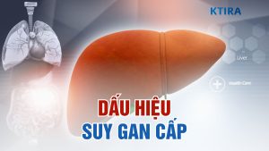 Dấu hiệu suy gan cấp
