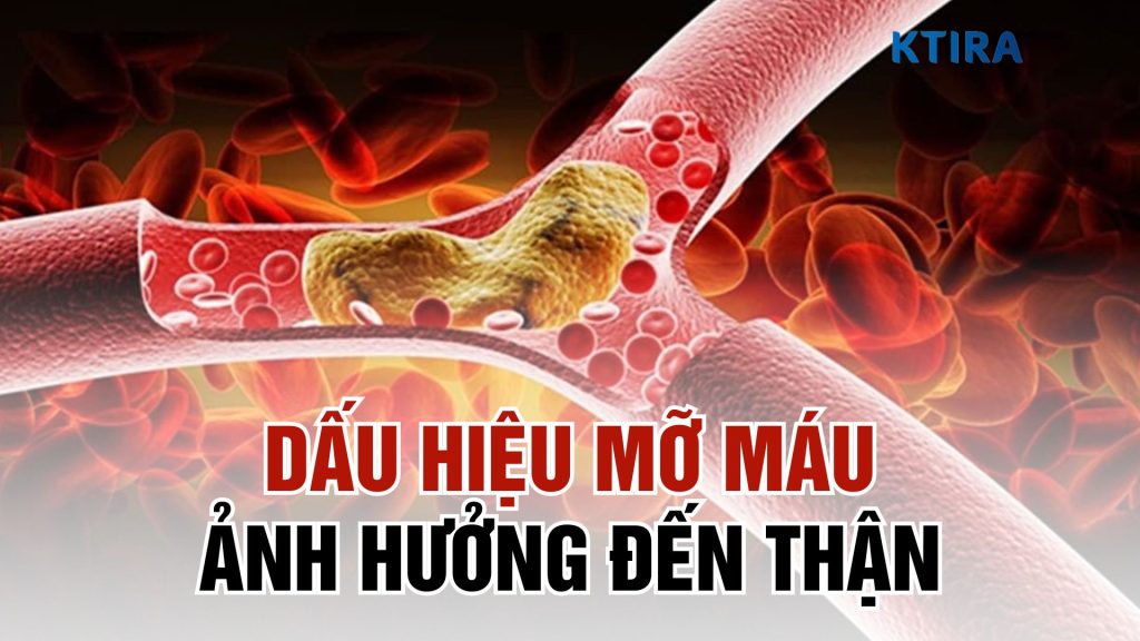 Dấu hiệu mỡ máu ảnh hưởng đến thận
