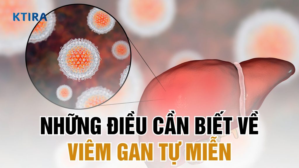 Viêm gan tự miễn