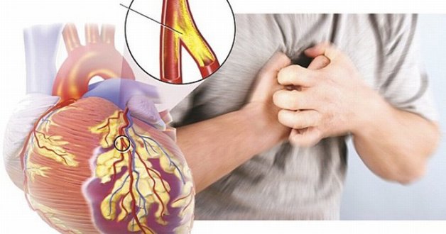 Dấu hiệu tắc nghẽn mạch tim