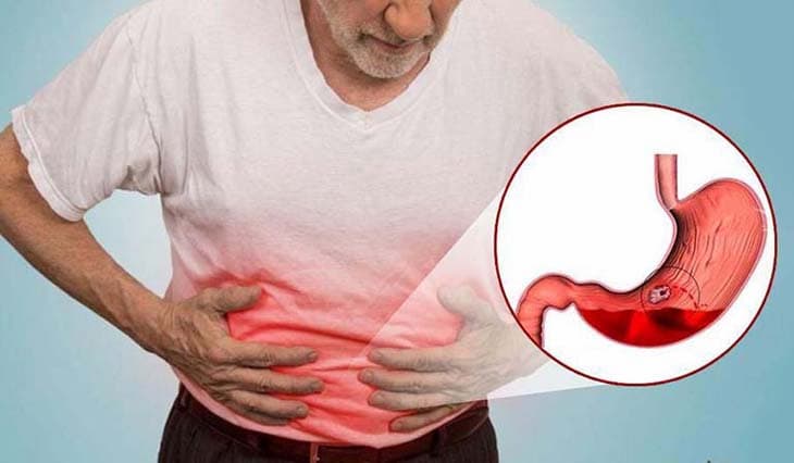Hiểu Về Dạ Dày Và Vai Trò Của Nó KTIRA