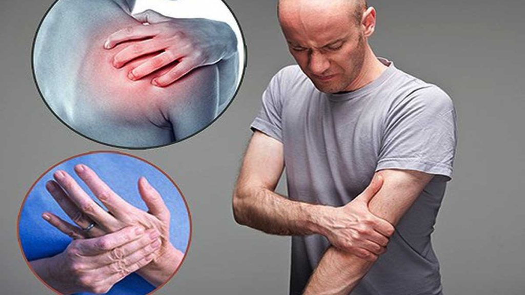 Dấu hiệu thoát vị đĩa đệm