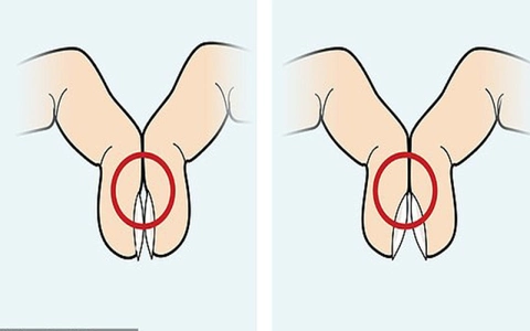 Phát hiện nguy cơ ung thư phổi