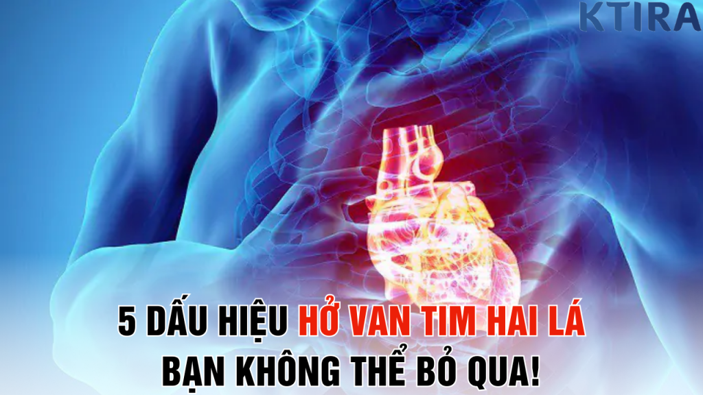 5 Dấu Hiệu Hở Van Tim Hai Lá Bạn Không Thể Bỏ Qua!