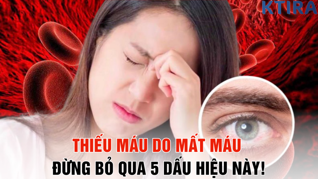 Thiếu Máu Do Mất Máu Đừng Bỏ Qua 5 Dấu Hiệu Này!
