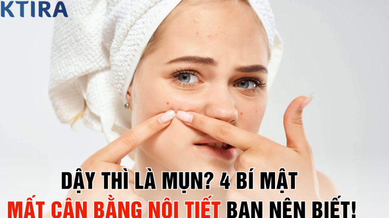 Tuổi Dậy Thì Có Phải Chỉ Là Mụn? 4 Bí Mật Về Mất Cân Bằng Nội Tiết Mà Bạn Chưa Biết!