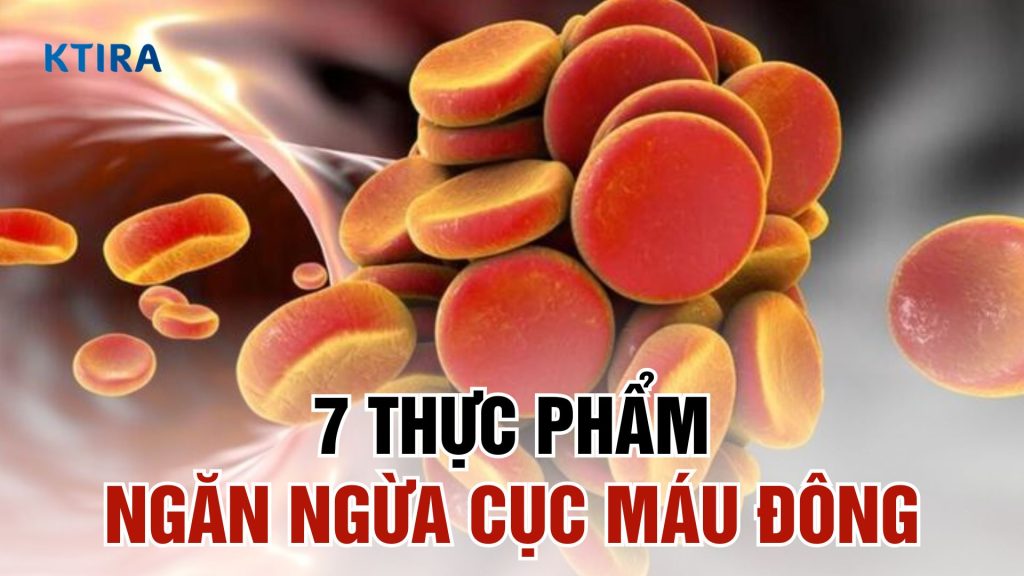 Thực phẩm ngăn ngừa cục máu đông hiệu quả