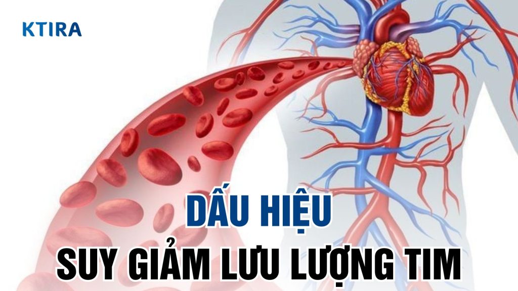 Dấu hiệu suy giảm lưu lượng tim