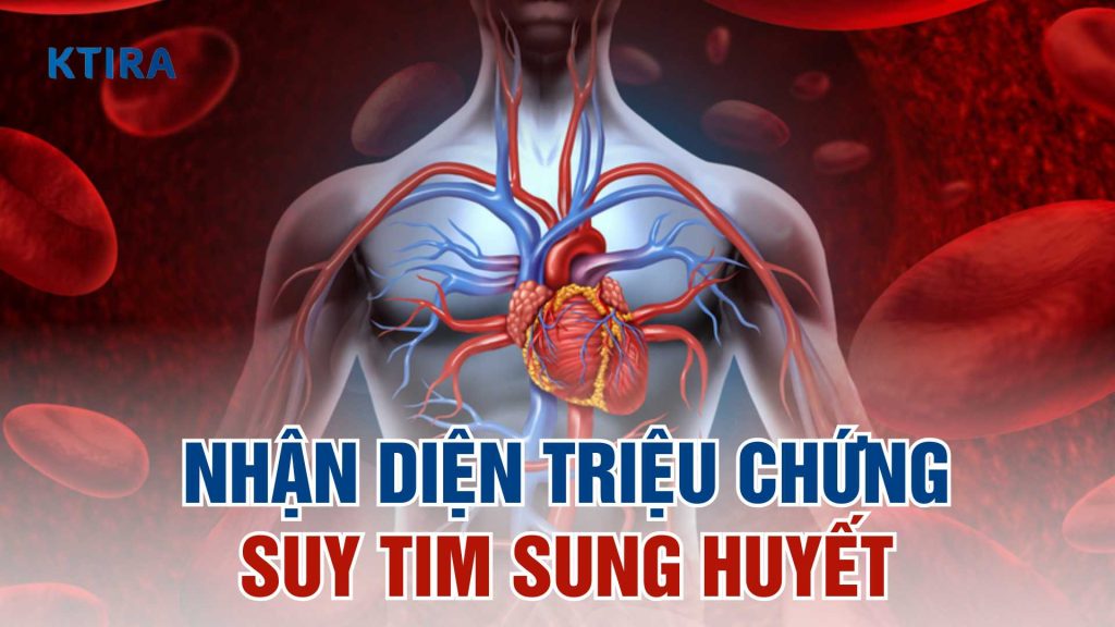 Triệu chứng suy tim sung huyết