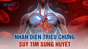 Triệu chứng suy tim sung huyết