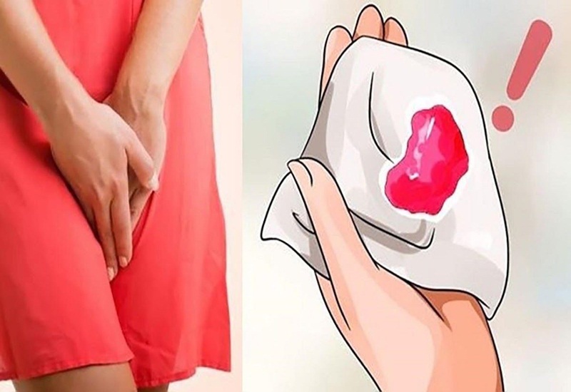 Dấu hiệu nhiễm HPV