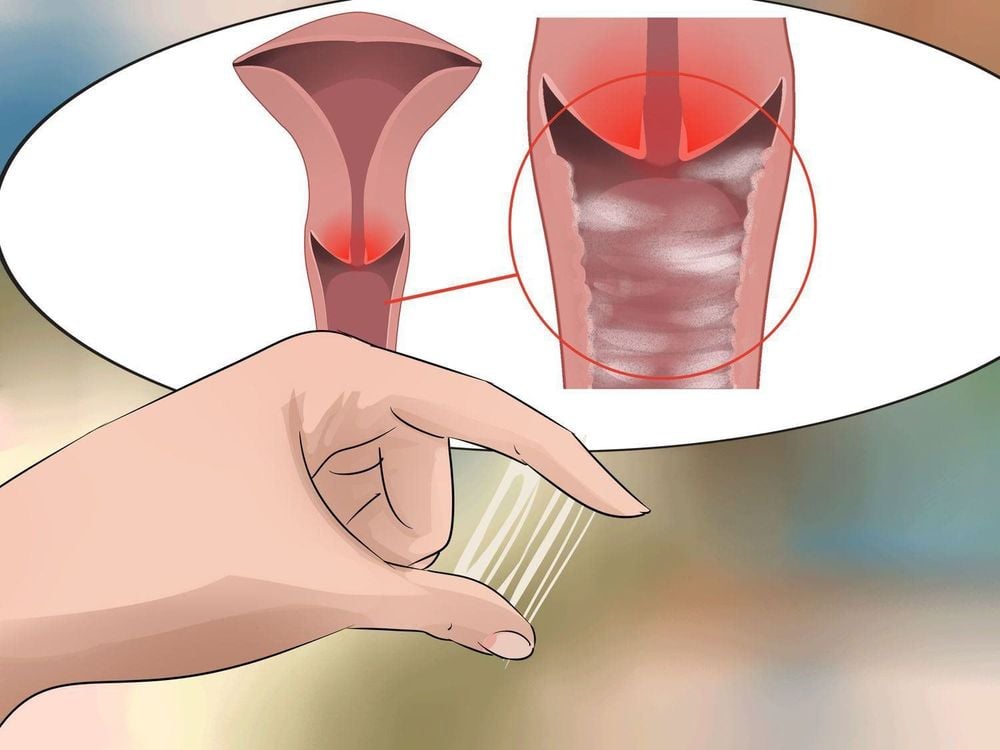 Dấu hiệu nhiễm HPV