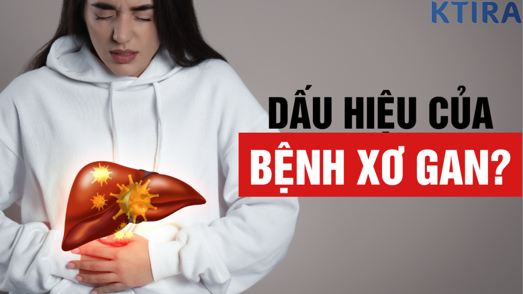 5 Dấu Hiệu Nguy Hiểm Của Bệnh Xơ Gan