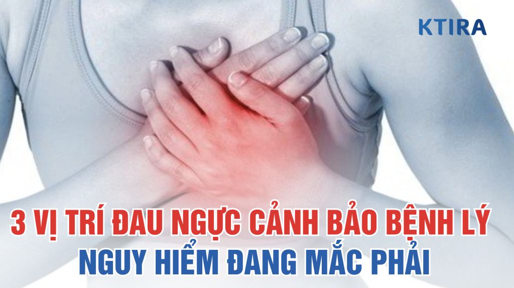 VỊ TRÍ ĐAU NGỰC CẢNH BẢO BỆNH LÝ NGUY HIỂM KTIRA