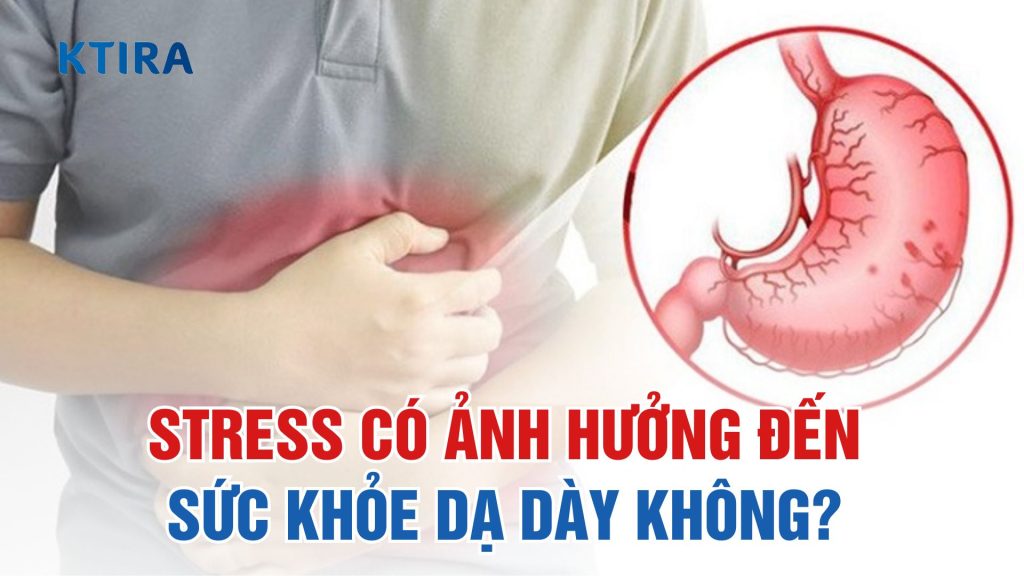 Stress có ảnh hưởng đến sức khỏe dạ dày không? KTIRA