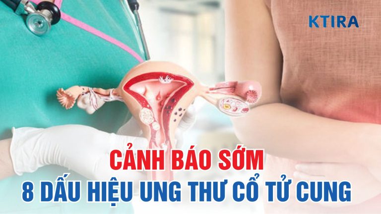 Cảnh Báo Sớm 8 Dấu Hiệu Ung Thư Cổ Tử Cung Phụ Nữ Tuyệt Đối Không Được Bỏ Qua