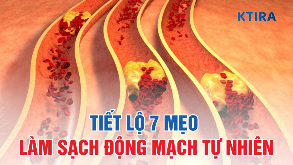 Mẹo Làm Sạch Động Mạch KTIRA