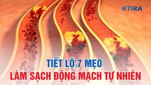 Mẹo Làm Sạch Động Mạch KTIRA