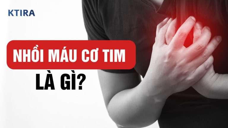 Nhồi Máu Cơ Tim Là Gì? 5 Tín Hiệu Cảnh Báo Và Bí Quyết Giữ Trái Tim Khỏe!