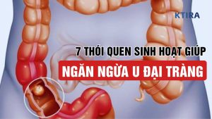 Ngăn Ngừa U Đại Tràng KTIRA