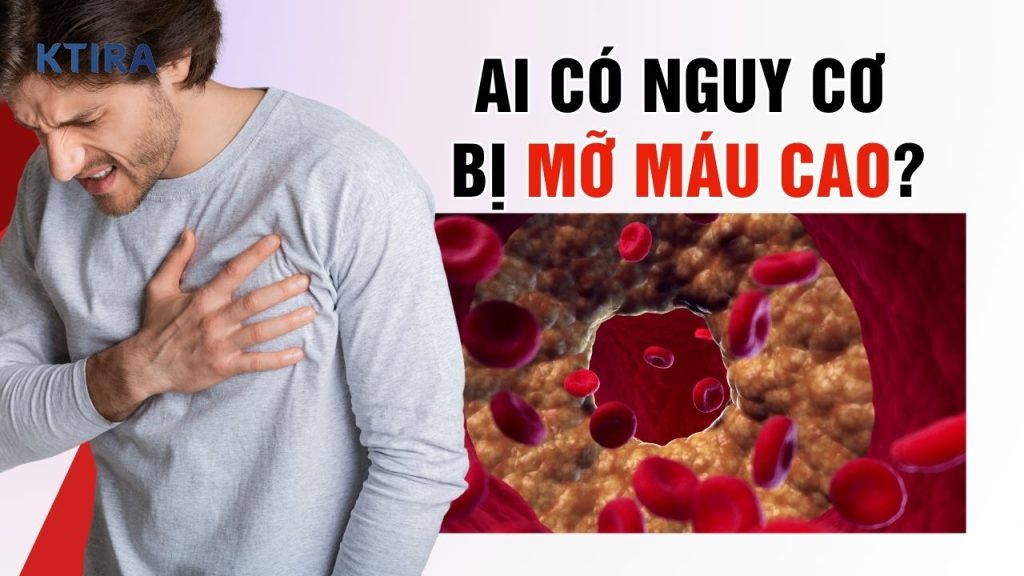 Ai Có Nguy Cơ Bị Mỡ Máu Cao?