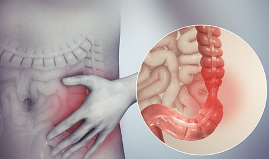 Nguyên Nhân Khiến Bạn Hay Bị Đau Dạ Dày Sau Khi Ăn KTIRA 