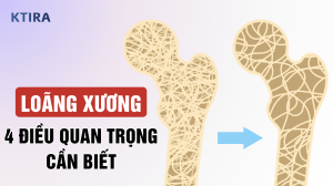 Bệnh Loãng Xương KTIRA