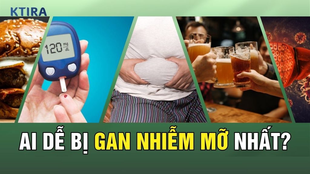 ai dễ bị gan nhiễm mỡ nhất