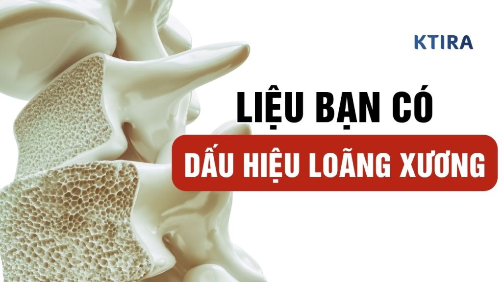 Dấu hiệu loãng xương là gì?