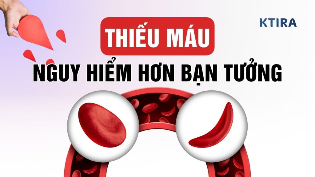 Thiếu Máu Có Nguy Hiểm Không