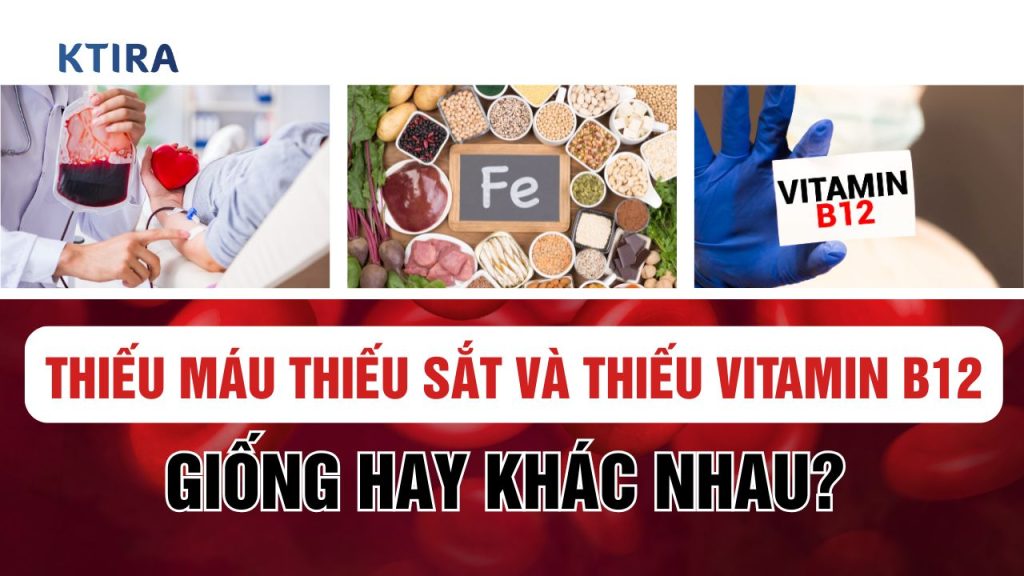 Thiếu Máu Thiếu Sắt Và Thiếu Vitamin B12