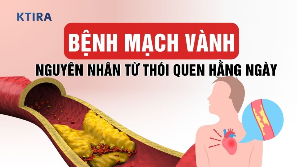 Bệnh Mạch Vành