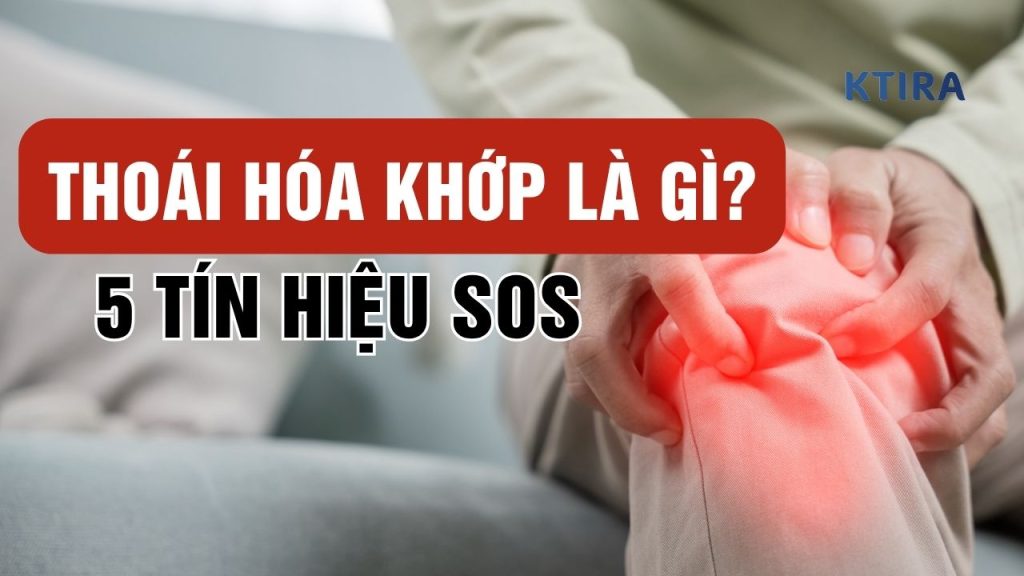 Thoái Hóa Khớp Là Gì? 5 Tín Hiệu SOS Và Cách Giữ Khớp Linh Hoạt!