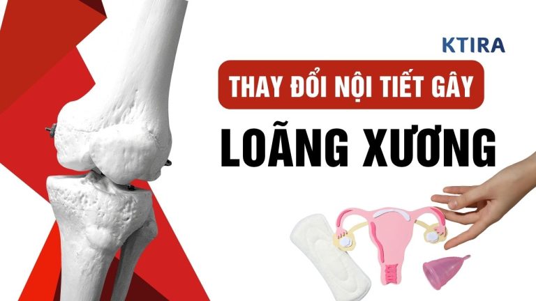 Loãng Xương Do Thay Đổi Nội Tiết Tố Nữ? 5 Bí Mật Bạn Cần Biết