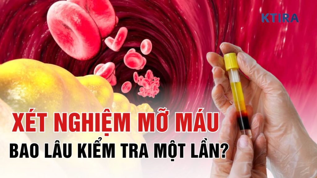 Xét Nghiệm Mỡ Máu KTIRA