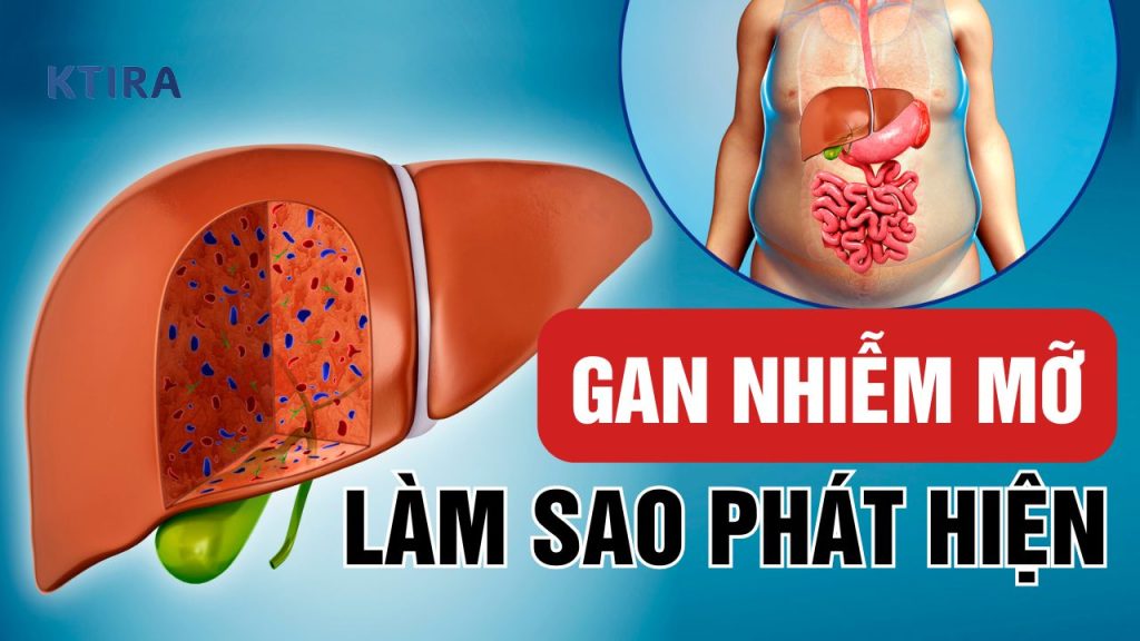 Làm sao phát hiện gan nhiễm mỡ?