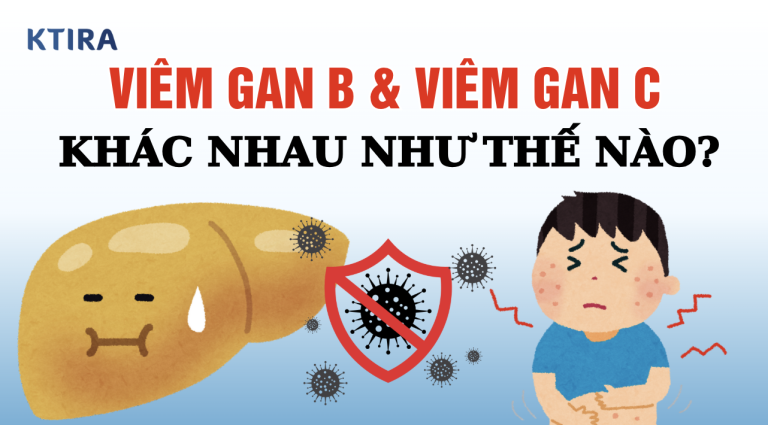 Triệu Chứng Sớm Của Viêm Gan B Và Viêm Gan C Khác Nhau Thế Nào? Cùng KTIRA Giải Đáp Chi Tiết