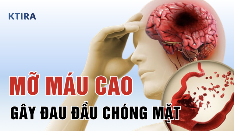 Mỡ Máu Cao Có Gây Đau Đầu Chóng Mặt Không? Sự Thật Bất Ngờ Từ Góc Nhìn Chuyên Gia