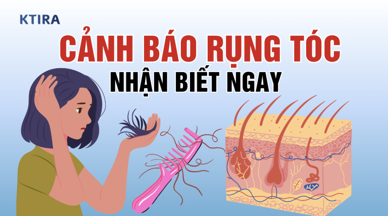 3 Dấu hiệu cảnh báo rụng tóc nhận biết để giữ tóc khỏe
