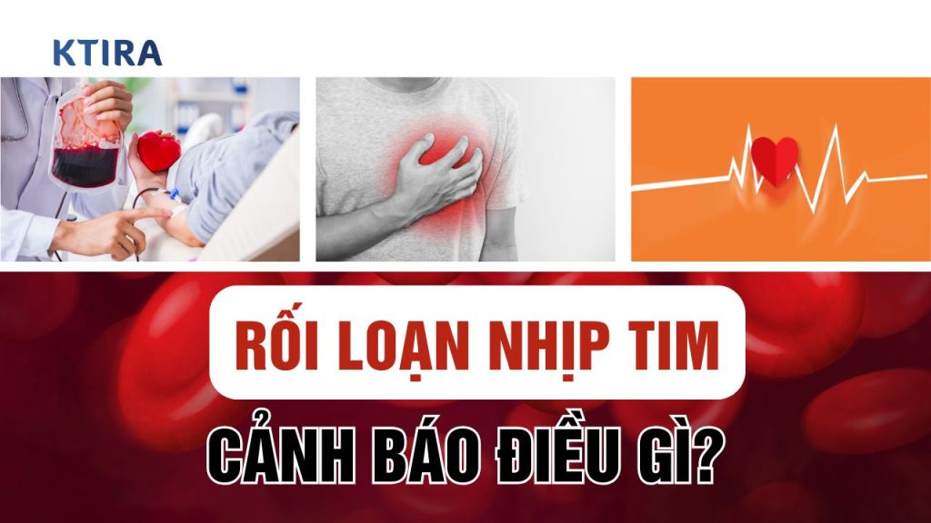Rối Loạn Nhịp Tim Cảnh Báo Điều Gì?