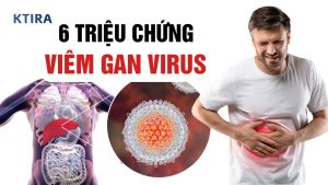 Triệu Chứng Viêm Gan Virus