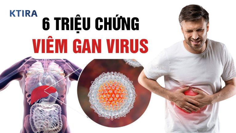 6 Triệu Chứng Viêm Gan Virus: Bạn Cần Biết!