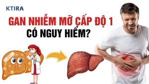 Gan Nhiễm Mỡ Cấp Độ 1